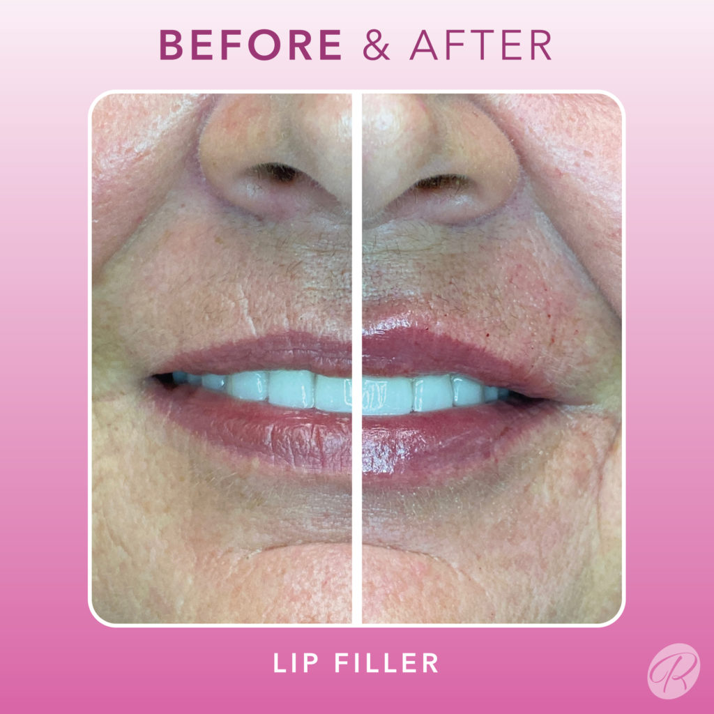 86641193